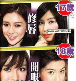 爆料整容直播视频大全最新,热门视频大盘点